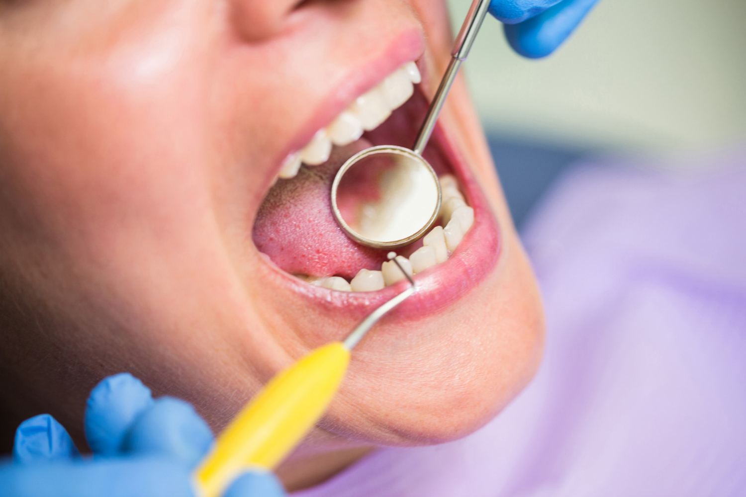 Dentist examining a female patient's teeth.